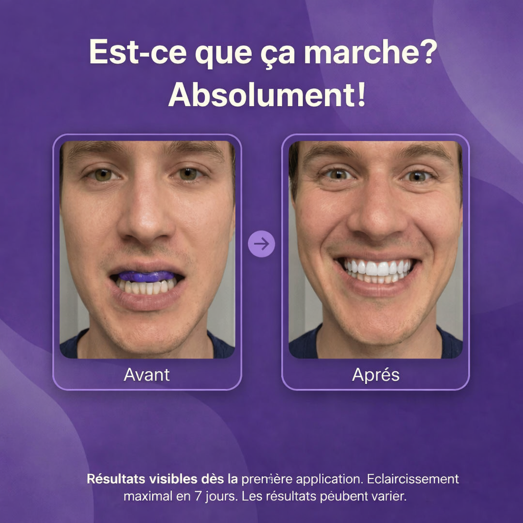 Vioren - Bandes blanchissantes violettes pour les dents